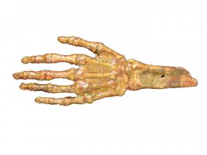Hand Rotted Flesh And Bone